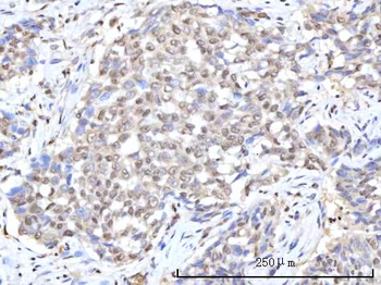 RANBP2 Rabbit Polyclonal Antibody