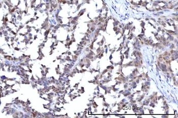 RANBP2 Rabbit Polyclonal Antibody