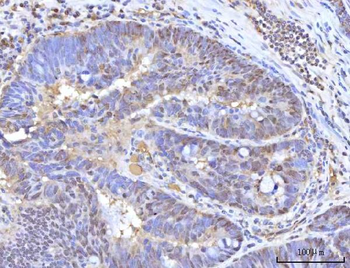 RANBP2 Rabbit Polyclonal Antibody