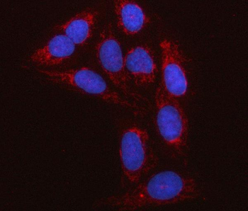 C18orf22/RBFA Rabbit Polyclonal Antibody