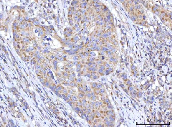 C18orf22/RBFA Rabbit Polyclonal Antibody