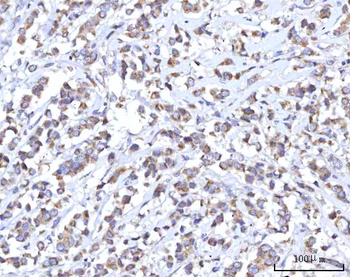 C18orf22/RBFA Rabbit Polyclonal Antibody