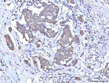 C18orf22/RBFA Rabbit Polyclonal Antibody