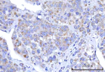 C18orf22/RBFA Rabbit Polyclonal Antibody