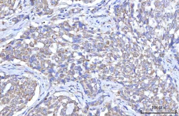C18orf22/RBFA Rabbit Polyclonal Antibody