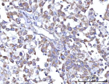 C18orf22/RBFA Rabbit Polyclonal Antibody