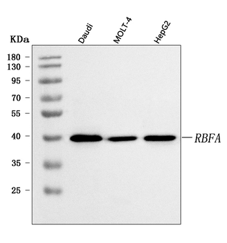 C18orf22/RBFA Rabbit Polyclonal Antibody
