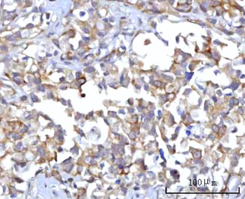 RAP1GAP Rabbit Polyclonal Antibody
