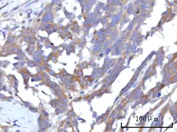 RAP1GAP Rabbit Polyclonal Antibody
