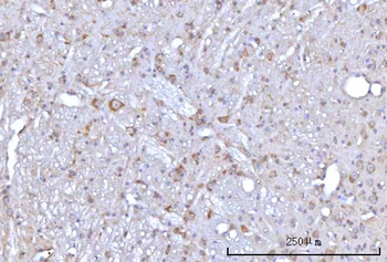 RAP1GAP Rabbit Polyclonal Antibody