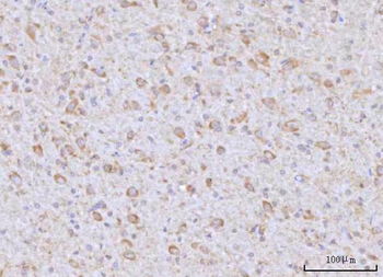 RAP1GAP Rabbit Polyclonal Antibody