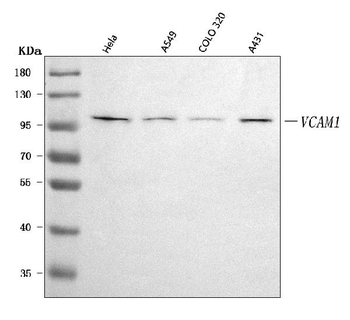 VCAM1 Rabbit Polyclonal Antibody
