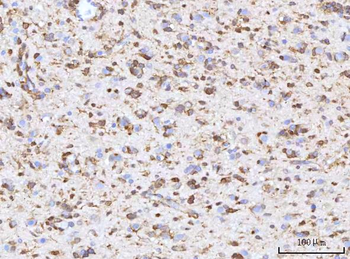 RBP1 Antibody