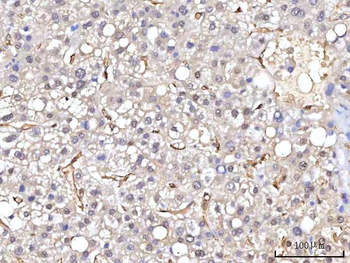 RBP1 Antibody
