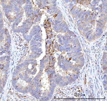 RBP1 Antibody