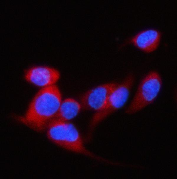 P97/DAP5/EIF4G2 Rabbit Polyclonal Antibody