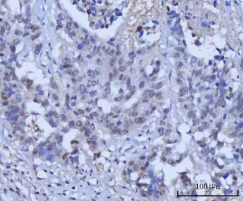 RAD51C Rabbit Polyclonal Antibody