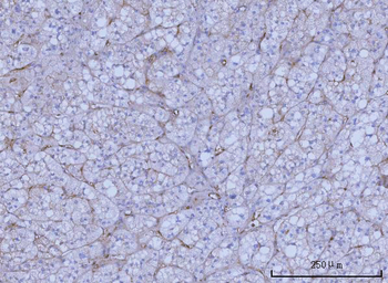 WRS/WARS1 Rabbit Polyclonal Antibody