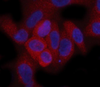 Hamartin/TSC1 Rabbit Polyclonal Antibody