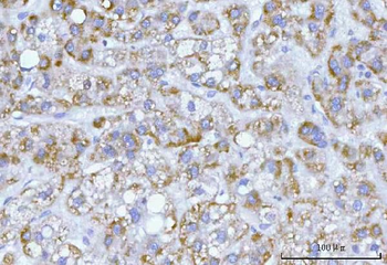 Hamartin/TSC1 Rabbit Polyclonal Antibody
