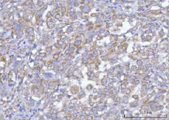 Hamartin/TSC1 Rabbit Polyclonal Antibody