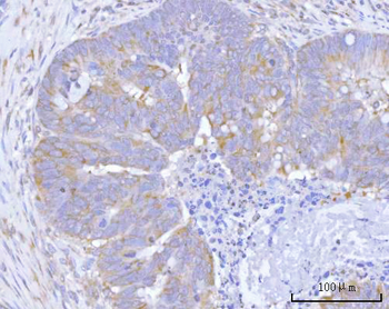 Hamartin/TSC1 Rabbit Polyclonal Antibody