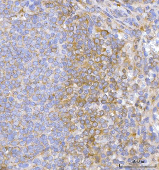 Hamartin/TSC1 Rabbit Polyclonal Antibody