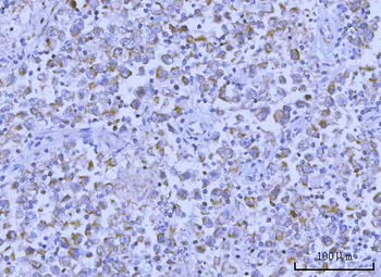 Hamartin/TSC1 Rabbit Polyclonal Antibody