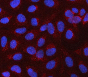 CBLIF Rabbit Polyclonal Antibody
