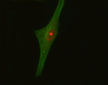 CRKL Rabbit Polyclonal Antibody