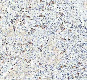 Chromogranin A/CHGA Antibody
