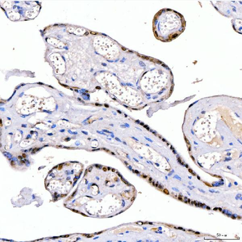 LIN28B Rabbit Polyclonal Antibody