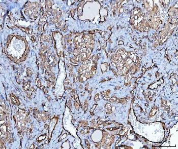PTRF/CAVIN1 Antibody