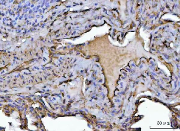 PTRF/CAVIN1 Antibody