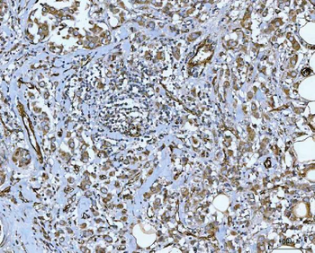 PTRF/CAVIN1 Antibody