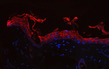 Cytokeratin 1/Krt1 Rabbit Polyclonal Antibody