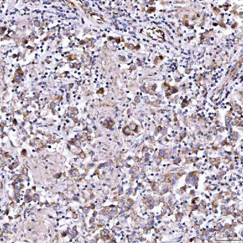 RAB3GAP1 Rabbit Polyclonal Antibody