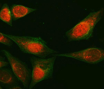 RAB3GAP1 Rabbit Polyclonal Antibody