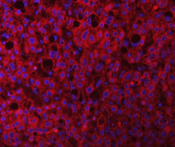 RAB3GAP1 Rabbit Polyclonal Antibody