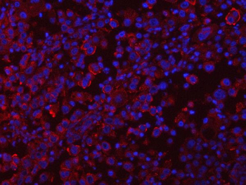 RAB3GAP1 Rabbit Polyclonal Antibody