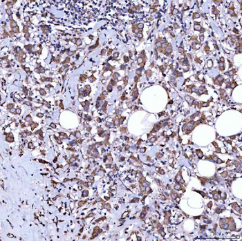 RAB3GAP1 Rabbit Polyclonal Antibody