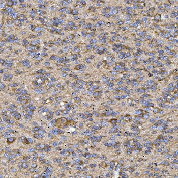 RAB3GAP1 Rabbit Polyclonal Antibody