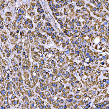 RAB3GAP1 Rabbit Polyclonal Antibody