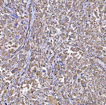 RAB3GAP1 Rabbit Polyclonal Antibody