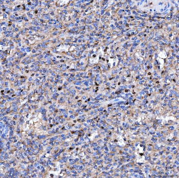 RAB3GAP1 Rabbit Polyclonal Antibody