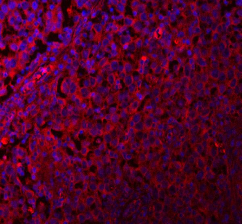 QARS1 Rabbit Polyclonal Antibody