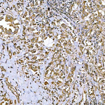 QARS1 Rabbit Polyclonal Antibody