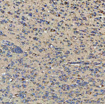 QARS1 Rabbit Polyclonal Antibody