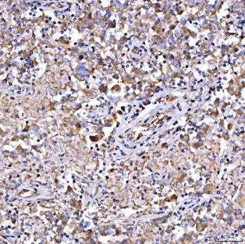 QARS1 Rabbit Polyclonal Antibody