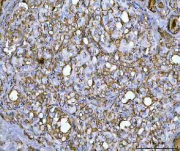 QARS1 Rabbit Polyclonal Antibody